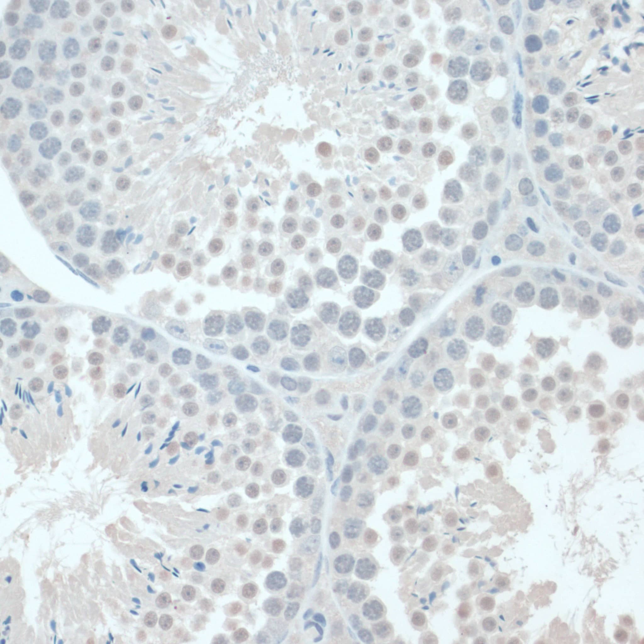 Immunohistochemistry: GAPDH-2 Antibody - BSA Free [GAPDH-2] - Immunohistochemistry analysis of paraffin-embedded Mouse testis using GAPDH-2 Rabbit pAb  at dilution of 1:100 (40x lens).Perform microwave antigen retrieval with 10 mM PBS buffer pH 7.2 before commencing with IHC staining protocol