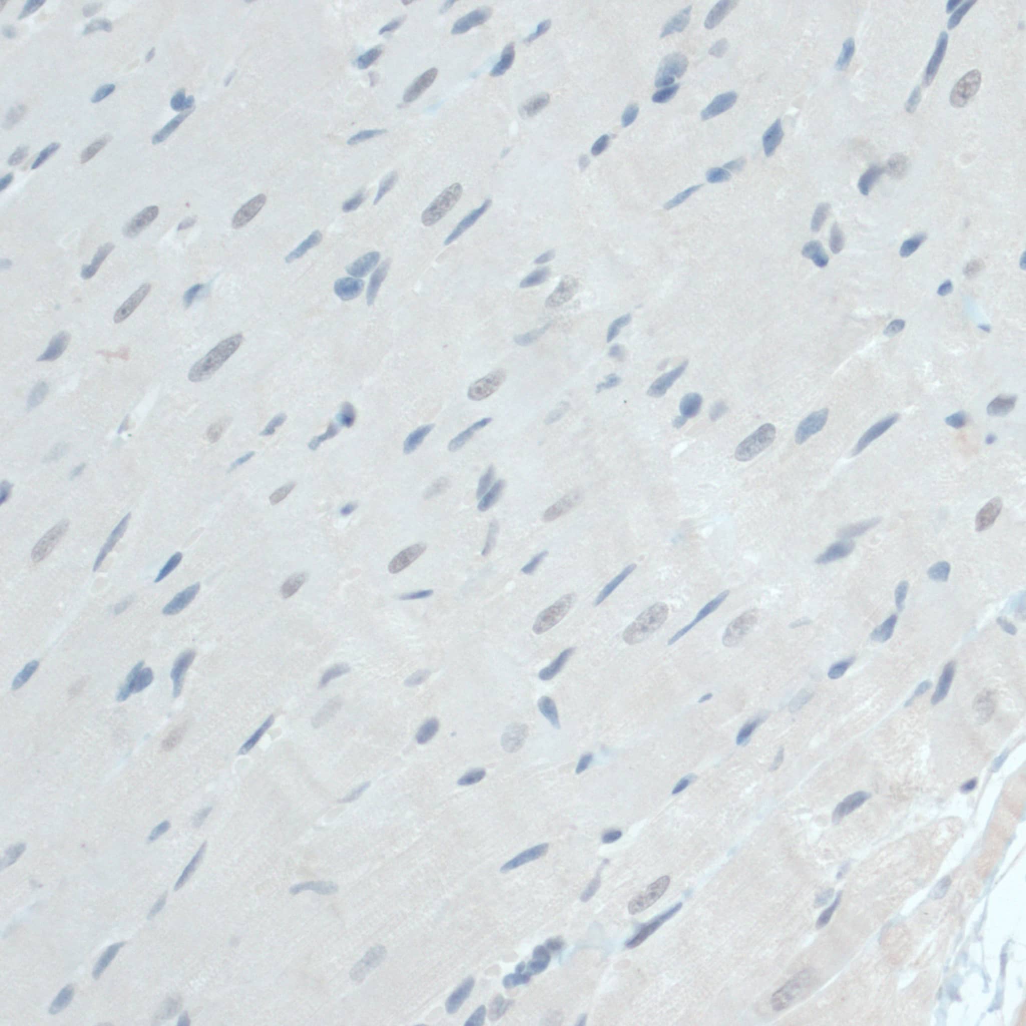 Immunohistochemistry: GAPDH-2 Antibody - BSA Free [GAPDH-2] - Immunohistochemistry analysis of paraffin-embedded Rat heart using GAPDH-2 Rabbit pAb  at dilution of 1:100 (40x lens).Perform microwave antigen retrieval with 10 mM PBS buffer pH 7.2 before commencing with IHC staining protocol