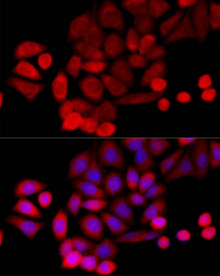 Immunocytochemistry/ Immunofluorescence: PIDD Antibody - BSA Free [PIDD] - Immunofluorescence analysis of HeLa cells using PIDD Rabbit pAb  at dilution of 1:100 (40x lens). Secondary antibody: Cy3 Goat Anti-Rabbit IgG (H+L)  at 1:500 dilution. Blue: DAPI for nuclear staining.