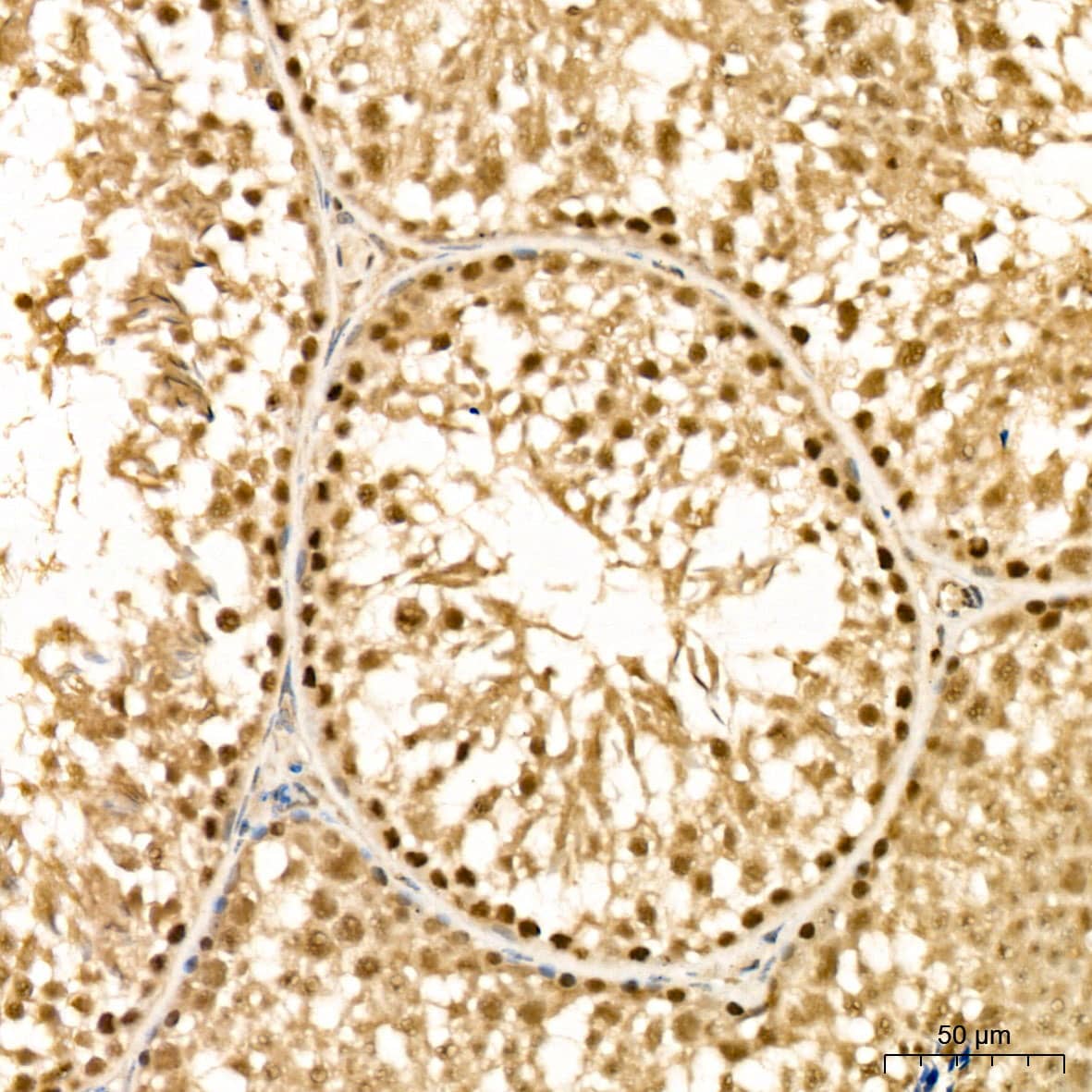 Immunohistochemistry Methionine Sulfoxide Reductase B Antibody - BSA Free