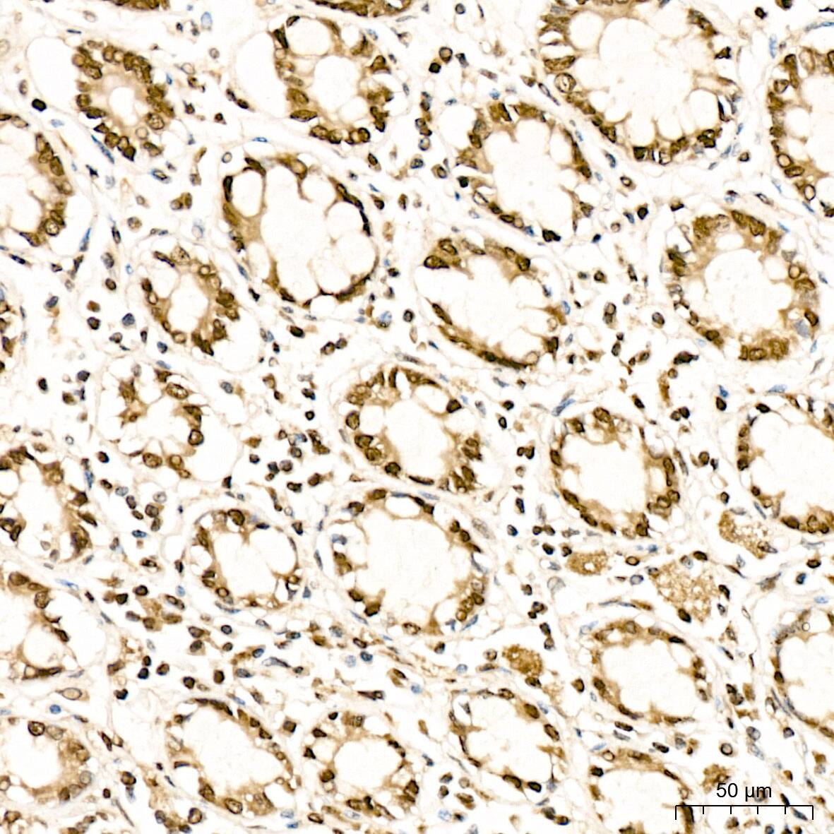 Immunohistochemistry: Methionine Sulfoxide Reductase B Antibody - BSA Free [NBP3-03548] - Immunohistochemistry analysis of Methionine Sulfoxide Reductase B in paraffin-embedded Human colon tissue using Methionine Sulfoxide Reductase B Rabbit pAb (A6737) at a dilution of  1:300 (40x lens). High pressure antigen retrieval was performed with 0.01 M citrate buffer (pH 6.0) prior to IHC staining.