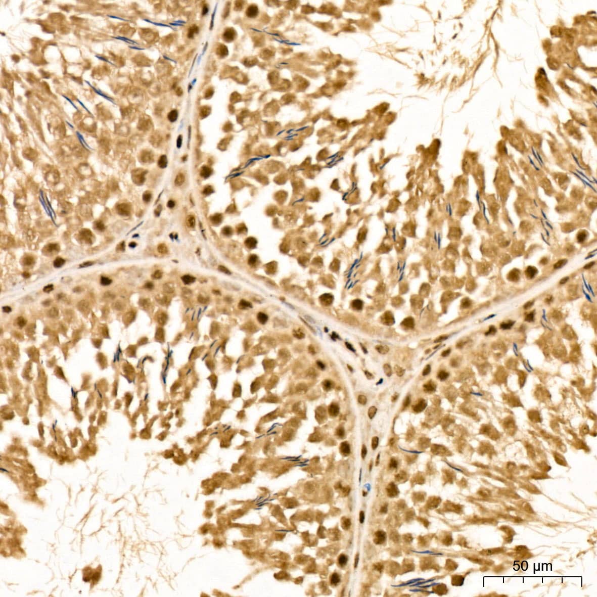 Immunohistochemistry: Methionine Sulfoxide Reductase B Antibody - BSA Free [NBP3-03548] - Immunohistochemistry analysis of Methionine Sulfoxide Reductase B in paraffin-embedded Rat testis tissue using Methionine Sulfoxide Reductase B Rabbit pAb (A6737) at a dilution of  1:300 (40x lens). High pressure antigen retrieval was performed with 0.01 M citrate buffer (pH 6.0) prior to IHC staining.