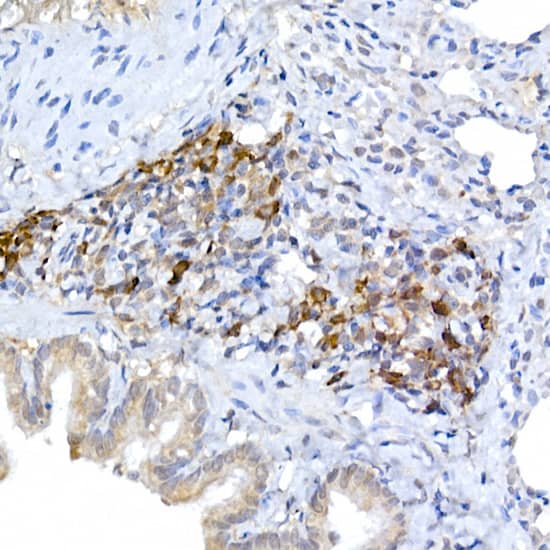 Immunohistochemistry: MLL5 Antibody - Azide and BSA Free [MLL5] - Immunohistochemistry analysis of paraffin-embedded Rat lung using MLL5 Rabbit pAb  at dilution of 1:50 (40x lens). High pressure antigen retrieval performed with 0.01M Citrate Bufferr (pH 6.0) prior to IHC staining.