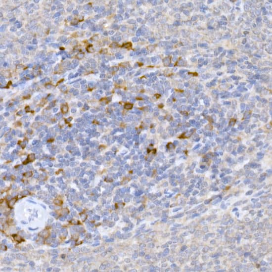 Immunohistochemistry: MLL5 Antibody - Azide and BSA Free [MLL5] - Immunohistochemistry analysis of paraffin-embedded Rat spleen using MLL5 Rabbit pAb  at dilution of 1:50 (40x lens). High pressure antigen retrieval performed with 0.01M Citrate Bufferr (pH 6.0) prior to IHC staining.