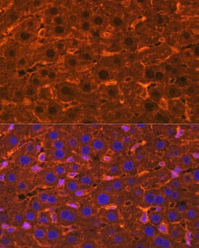 Immunocytochemistry/ Immunofluorescence: Ceruloplasmin Antibody - Azide and BSA Free [Ceruloplasmin] - Immunofluorescence analysis of paraffin-embedded Rat liver using Ceruloplasmin Rabbit pAb  at dilution of 1:100. Secondary antibody: Cy3-conjugated Goat anti-Rabbit IgG (H+L)  at 1:500 dilution. Blue: DAPI for nuclear staining.