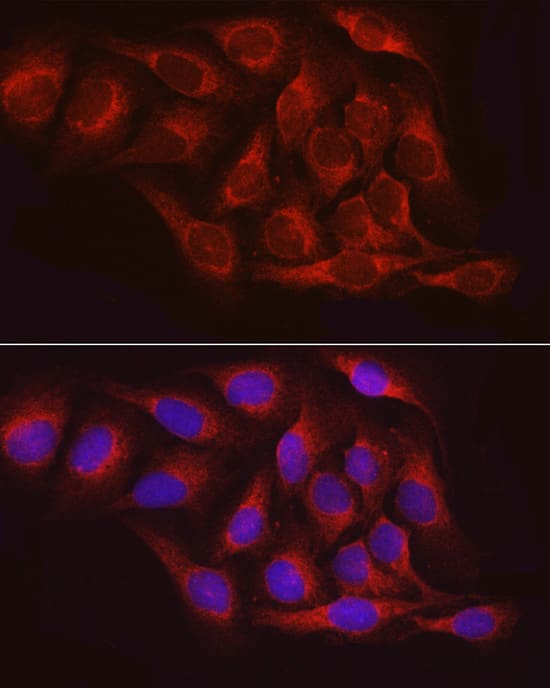 Immunocytochemistry/ Immunofluorescence: PTP1B/PTPN1 Antibody - Azide and BSA Free [NBP3-03634] - Immunofluorescence analysis of U2OS cells using PTP1B/PTPN1 Rabbit pAb (A1590) at dilution of 1:100 (40x lens). Blue: DAPI for nuclear staining.