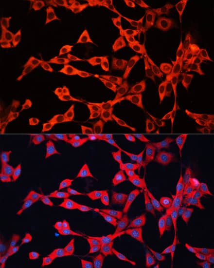 Immunocytochemistry/ Immunofluorescence GDI2 Antibody - BSA Free