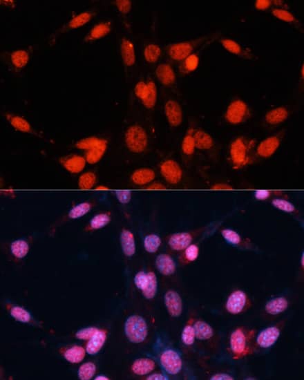 Immunocytochemistry/ Immunofluorescence: FUS Antibody - BSA Free [NBP3-03651] - Immunofluorescence analysis of NIH/3T3 cells using [KO Validated] FUS Rabbit pAb (A5921) at dilution of 1:100. Secondary antibody: Cy3 Goat Anti-Rabbit IgG (H+L) (AS007) at 1:500 dilution. Blue: DAPI for nuclear staining.