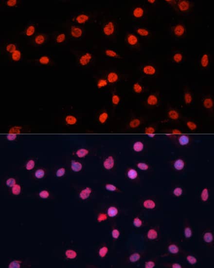 Immunocytochemistry/ Immunofluorescence: FUS Antibody - BSA Free [NBP3-03651] - Immunofluorescence analysis of C6 cells using [KO Validated] FUS Rabbit pAb (A5921) at dilution of 1:100. Secondary antibody: Cy3 Goat Anti-Rabbit IgG (H+L) (AS007) at 1:500 dilution. Blue: DAPI for nuclear staining.