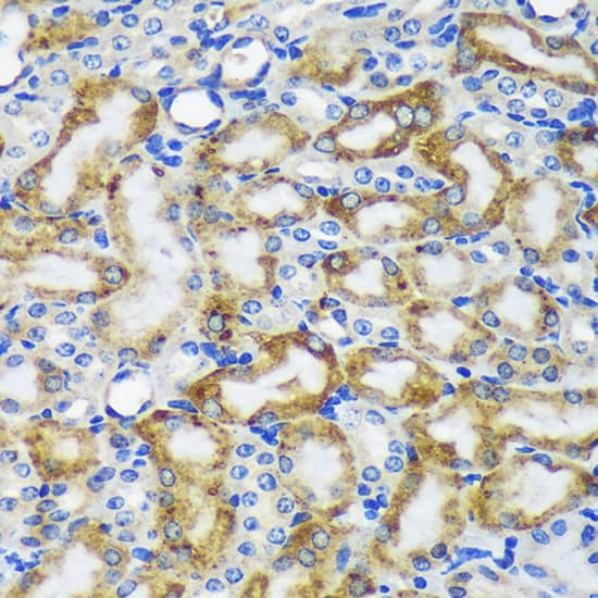 Immunohistochemistry: MKK4/MEK4 Antibody - BSA Free [MKK4/MEK4] - Immunohistochemistry analysis of paraffin-embedded Mouse kidney using MKK4/MEK4 Rabbit pAb  at dilution of  1:100 (40x lens). Microwave antigen retrieval performed with 0.01M PBS Buffer (pH 7.2) prior to IHC staining.