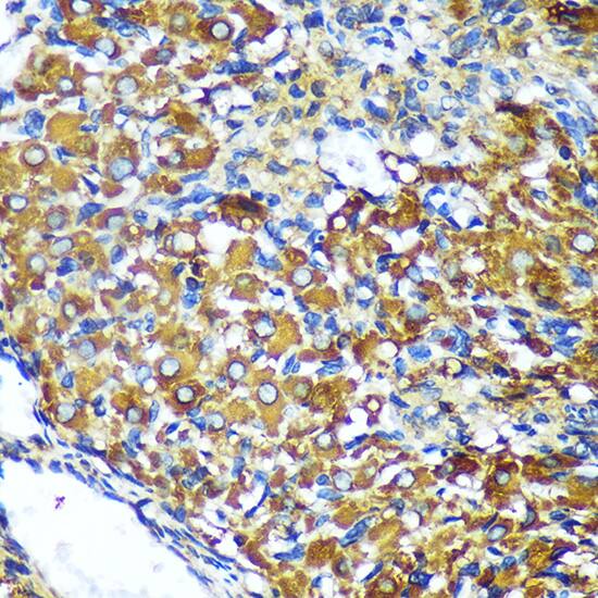 Immunohistochemistry: MKK4/MEK4 Antibody - BSA Free [MKK4/MEK4] - Immunohistochemistry analysis of paraffin-embedded Rat ovary using MKK4/MEK4 Rabbit pAb  at dilution of  1:100 (40x lens). Microwave antigen retrieval performed with 0.01M PBS Buffer (pH 7.2) prior to IHC staining.