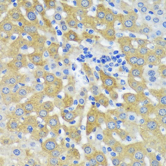 Immunohistochemistry: MKK4/MEK4 Antibody - BSA Free [MKK4/MEK4] - Immunohistochemistry analysis of paraffin-embedded Mouse liver using MKK4/MEK4 Rabbit pAb  at dilution of  1:100 (40x lens). Microwave antigen retrieval performed with 0.01M PBS Buffer (pH 7.2) prior to IHC staining.