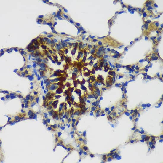 Immunohistochemistry: MKK4/MEK4 Antibody - BSA Free [MKK4/MEK4] - Immunohistochemistry analysis of paraffin-embedded Rat lung using MKK4/MEK4 Rabbit pAb  at dilution of  1:100 (40x lens). Microwave antigen retrieval performed with 0.01M PBS Buffer (pH 7.2) prior to IHC staining.