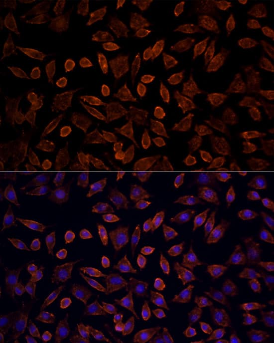 Immunocytochemistry/ Immunofluorescence: KRAS Antibody - Azide and BSA Free [NBP3-03659] - Immunofluorescence analysis of L929 cells using [KO Validated] KRAS Rabbit pAb (A12704) at dilution of 100 (40x lens). Secondary antibody: Cy3 Goat Anti-Rabbit IgG (H+L) (AS007) at 1:500 dilution. Blue: DAPI for nuclear staining.