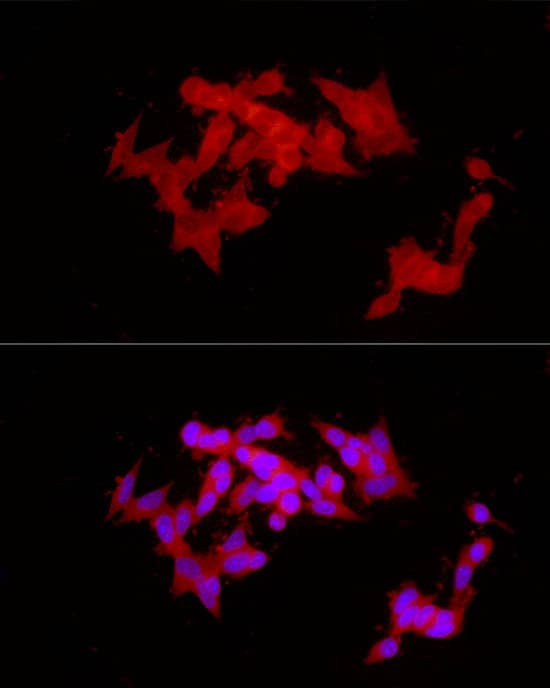 Immunocytochemistry/ Immunofluorescence GLT25D1 Antibody - Azide and BSA Free