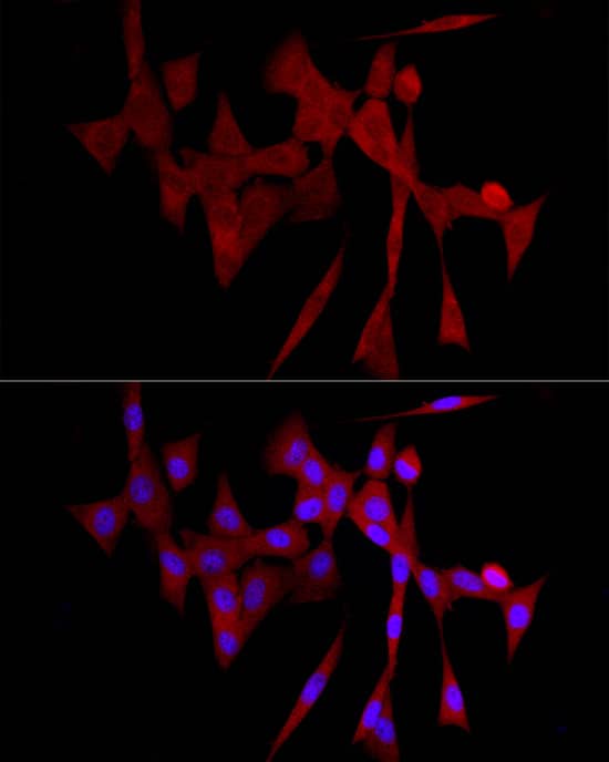 Immunocytochemistry/ Immunofluorescence: GLT25D1 Antibody - Azide and BSA Free [NBP3-03665] - Immunofluorescence analysis of NIH/3T3 cells using GLT25D1 Rabbit pAb (A16571) at dilution of 1:100 (40x lens). Blue: DAPI for nuclear staining.