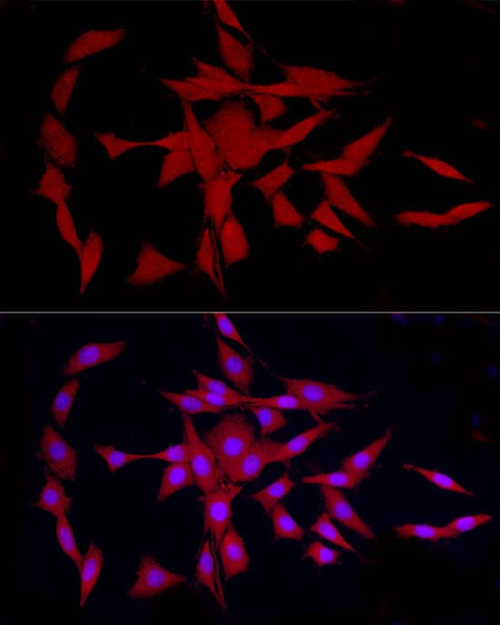 Immunocytochemistry/ Immunofluorescence: GLT25D1 Antibody - Azide and BSA Free [NBP3-03665] - Immunofluorescence analysis of PC-12 cells using GLT25D1 Rabbit pAb (A16571) at dilution of 1:100 (40x lens). Blue: DAPI for nuclear staining.