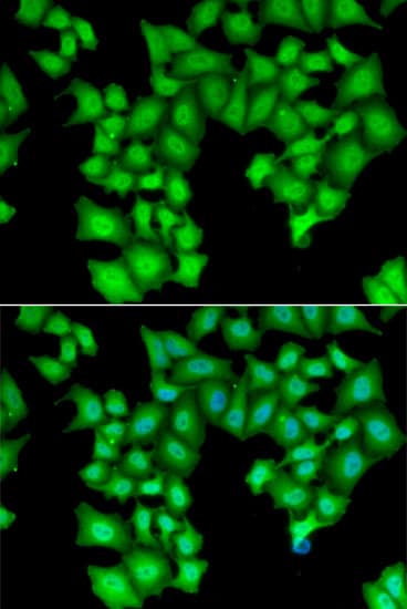 Immunocytochemistry/ Immunofluorescence INTS11 Antibody - BSA Free