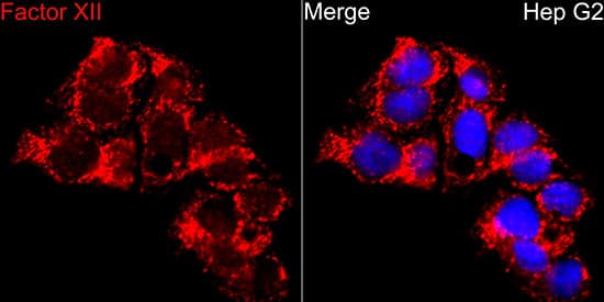 Immunocytochemistry/ Immunofluorescence: Factor XII Antibody - BSA Free [Factor XII] - Immunofluorescence analysis of HepG2 cells using Factor XII Rabbit pAb  at dilution of 1:200 (40x lens). Secondary antibody: Cy3-conjugated Goat anti-Rabbit IgG (H+L)  at 1:500 dilution. Blue: DAPI for nuclear staining.