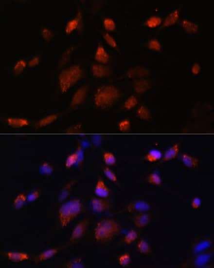 <b>Genetic Strategies Validation. </b>Immunocytochemistry/ Immunofluorescence: Tmp21/p23 Antibody - Azide and BSA Free [Tmp21/p23] - Immunofluorescence analysis of NIH-3T3 cells using Tmp21/p23 Rabbit pAb  at dilution of 1:100. Secondary antibody: Cy3-conjugated Goat anti-Rabbit IgG (H+L)  at 1:500 dilution. Blue: DAPI for nuclear staining.