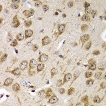 Immunohistochemistry: Tmp21/p23 Antibody - Azide and BSA Free [Tmp21/p23] - Immunohistochemistry analysis of paraffin-embedded Mouse brain using Tmp21/p23 Rabbit pAb  at dilution of 1:100 (40x lens). Microwave antigen retrieval performed with 0.01M PBS Buffer (pH 7.2) prior to IHC staining.