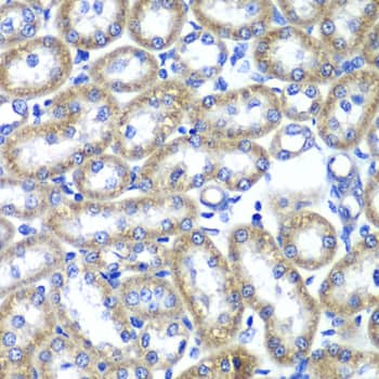 Immunohistochemistry: Tmp21/p23 Antibody - Azide and BSA Free [Tmp21/p23] - Immunohistochemistry analysis of paraffin-embedded Rat kidney using Tmp21/p23 Rabbit pAb  at dilution of 1:100 (40x lens). Microwave antigen retrieval performed with 0.01M PBS Buffer (pH 7.2) prior to IHC staining.