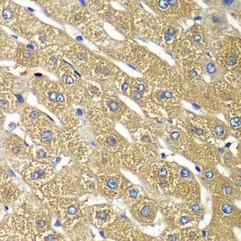 Immunohistochemistry: Tmp21/p23 Antibody - Azide and BSA Free [Tmp21/p23] - Immunohistochemistry analysis of paraffin-embedded Human liver damage using Tmp21/p23 Rabbit pAb  at dilution of 1:100 (40x lens). Microwave antigen retrieval performed with 0.01M PBS Buffer (pH 7.2) prior to IHC staining.
