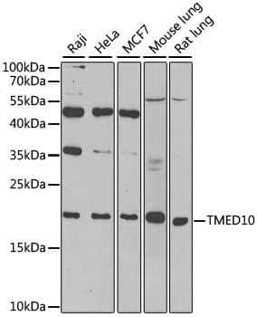 Western Blot: Tmp21/p23 Antibody - Azide and BSA Free [Tmp21/p23] - Western blot analysis of various lysates using Tmp21/p23 Rabbit pAb  at 1:1000 dilution.Secondary antibody: HRP-conjugated Goat anti-Rabbit IgG (H+L)  at 1:10000 dilution.Lysates/proteins: 25ug per lane.Blocking buffer: 3% nonfat dry milk in TBST.Detection: ECL Basic Kit .Exposure time: 90s.