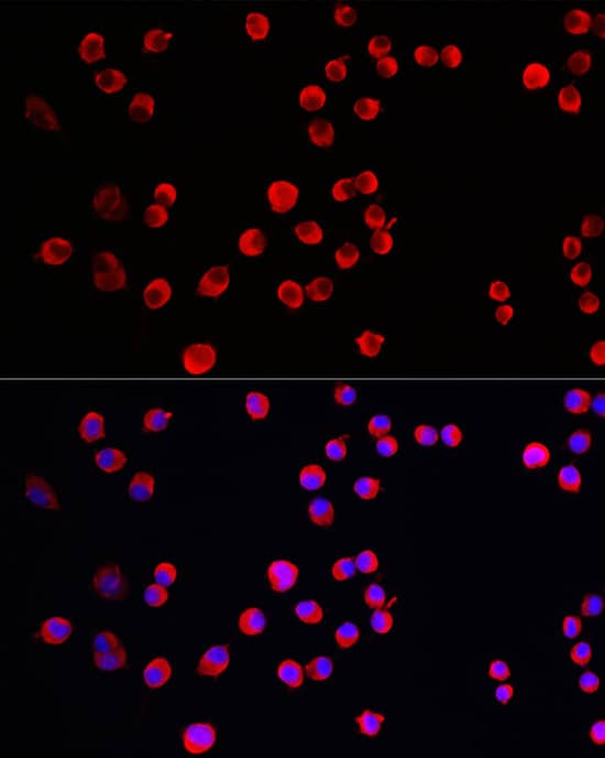 Immunocytochemistry/ Immunofluorescence: STEP Antibody - Azide and BSA Free [NBP3-03693] - Immunofluorescence analysis of Neuro-2a cells using STEP Rabbit pAb (A16585) at dilution of 1:100 (40x lens). Blue: DAPI for nuclear staining.