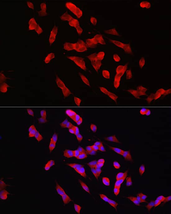 Immunocytochemistry/ Immunofluorescence: STEP Antibody - Azide and BSA Free [NBP3-03693] - Immunofluorescence analysis of SH-SY5Y cells using STEP Rabbit pAb (A16585) at dilution of 1:100 (40x lens). Blue: DAPI for nuclear staining.