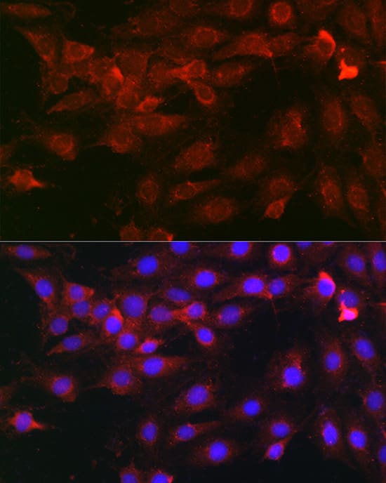 Immunocytochemistry/ Immunofluorescence: Heparanase/HPSE Antibody - Azide and BSA Free [Heparanase/HPSE] - Immunofluorescence analysis of C6 cells using Heparanase/HPSE Rabbit pAb  at dilution of 1:100 (40x lens). Secondary antibody: Cy3-conjugated Goat anti-Rabbit IgG (H+L)  at 1:500 dilution. Blue: DAPI for nuclear staining.