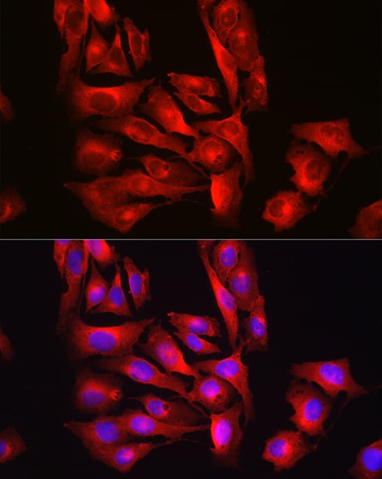 Immunocytochemistry/ Immunofluorescence: Glutathione Synthetase Antibody - Azide and BSA Free [NBP3-03702] - Immunofluorescence analysis of U2OS cells using [KO Validated] Glutathione Synthetase Rabbit pAb (A14535) at dilution of 1:100 (40x lens). Secondary antibody: Cy3 Goat Anti-Rabbit IgG (H+L) (AS007) at 1:500 dilution. Blue: DAPI for nuclear staining.