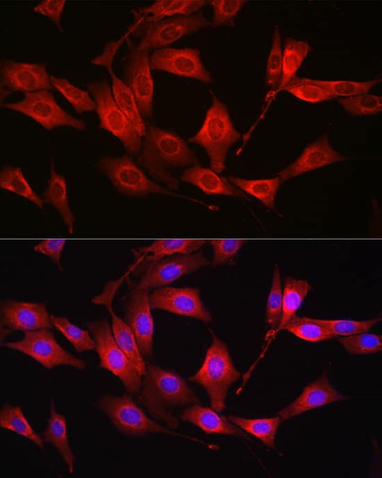 Immunocytochemistry/ Immunofluorescence: Glutathione Synthetase Antibody - Azide and BSA Free [NBP3-03702] - Immunofluorescence analysis of NIH/3T3 cells using [KO Validated] Glutathione Synthetase Rabbit pAb (A14535) at dilution of 1:100 (40x lens). Secondary antibody: Cy3 Goat Anti-Rabbit IgG (H+L) (AS007) at 1:500 dilution. Blue: DAPI for nuclear staining.