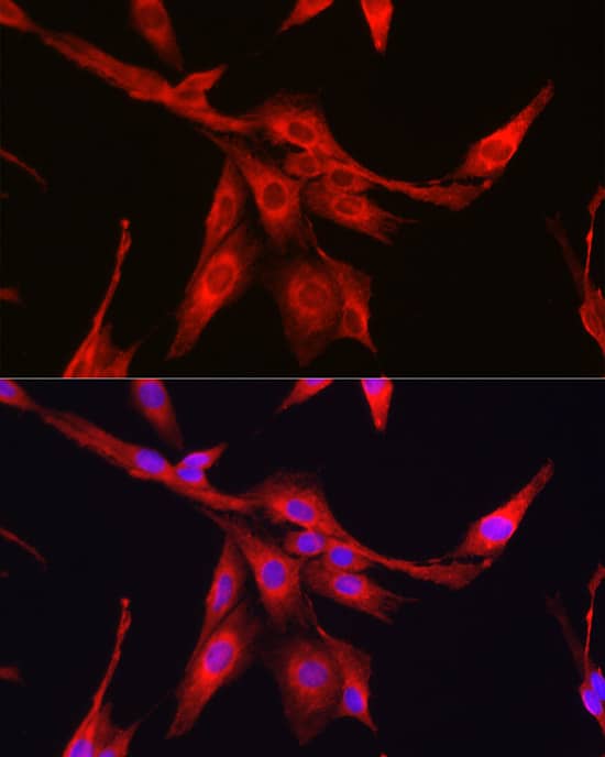 Immunocytochemistry/ Immunofluorescence: Glutathione Synthetase Antibody - Azide and BSA Free [NBP3-03702] - Immunofluorescence analysis of PC-12 cells using [KO Validated] Glutathione Synthetase Rabbit pAb (A14535) at dilution of 1:100 (40x lens). Secondary antibody: Cy3 Goat Anti-Rabbit IgG (H+L) (AS007) at 1:500 dilution. Blue: DAPI for nuclear staining.