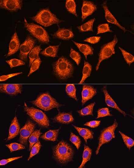 Immunocytochemistry/ Immunofluorescence: GADD34 Antibody - Azide and BSA Free [NBP3-03703] - Immunofluorescence analysis of L929 cells using GADD34 Rabbit pAb (A16260) at dilution of 1:100. Secondary antibody: Cy3 Goat Anti-Rabbit IgG (H+L) (AS007) at 1:500 dilution. Blue: DAPI for nuclear staining.