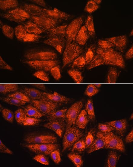 Immunocytochemistry/ Immunofluorescence: GADD34 Antibody - Azide and BSA Free [NBP3-03703] - Immunofluorescence analysis of H9C2 cells using GADD34 Rabbit pAb (A16260) at dilution of 1:100. Secondary antibody: Cy3 Goat Anti-Rabbit IgG (H+L) (AS007) at 1:500 dilution. Blue: DAPI for nuclear staining.