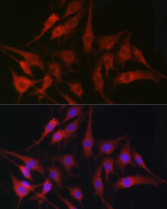 Immunocytochemistry/ Immunofluorescence: Fascin Antibody - BSA Free [Fascin] - Immunofluorescence analysis of C6 cells using [KO Validated] Fascin/Fascin Rabbit pAb  at dilution of 1:100 (40x lens). Secondary antibody: Cy3 Goat Anti-Rabbit IgG (H+L)  at 1:500 dilution. Blue: DAPI for nuclear staining.