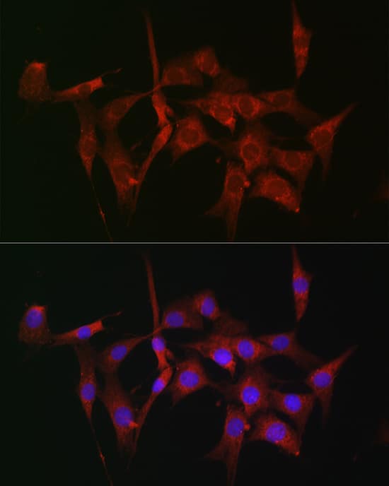 Immunocytochemistry/ Immunofluorescence: Fascin Antibody - BSA Free [Fascin] - Immunofluorescence analysis of NIH-3T3 cells using [KO Validated] Fascin/Fascin Rabbit pAb  at dilution of 1:100 (40x lens). Secondary antibody: Cy3 Goat Anti-Rabbit IgG (H+L)  at 1:500 dilution. Blue: DAPI for nuclear staining.