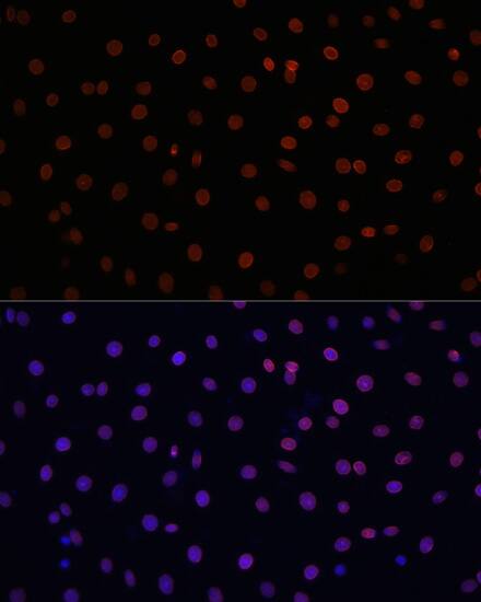 Immunocytochemistry/ Immunofluorescence: Lamin B1 Antibody - Azide and BSA Free [Lamin B1] - Immunofluorescence analysis of C6 cells using Lamin B1 Rabbit pAb  at dilution of 1:100. Secondary antibody: Cy3-conjugated Goat anti-Rabbit IgG (H+L)  at 1:500 dilution. Blue: DAPI for nuclear staining.