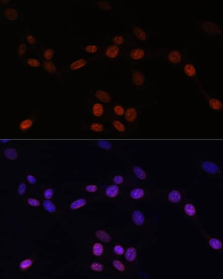 Immunocytochemistry/ Immunofluorescence: Lamin B1 Antibody - Azide and BSA Free [Lamin B1] - Immunofluorescence analysis of NIH/3T3 cells using Lamin B1 Rabbit pAb  at dilution of 1:100. Secondary antibody: Cy3-conjugated Goat anti-Rabbit IgG (H+L)  at 1:500 dilution. Blue: DAPI for nuclear staining.