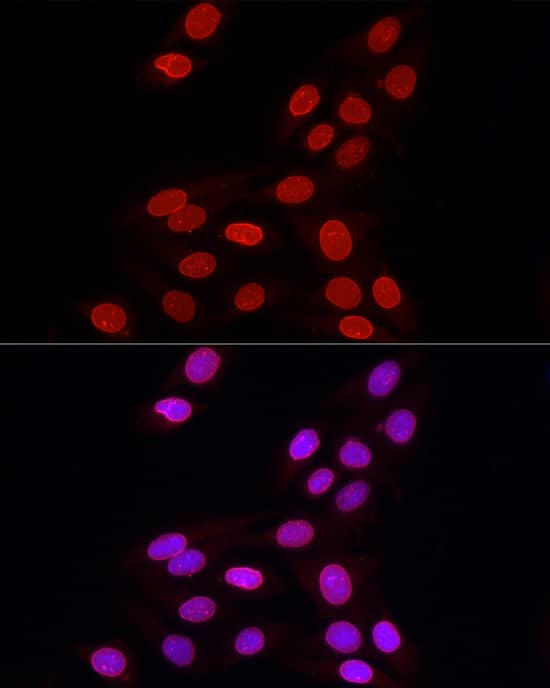 Immunocytochemistry/ Immunofluorescence: Lamin B1 Antibody - Azide and BSA Free [Lamin B1] - Immunofluorescence analysis of U2OS cells using Lamin B1 Rabbit pAb  at dilution of 1:100 (40x lens). Secondary antibody: Cy3-conjugated Goat anti-Rabbit IgG (H+L)  at 1:500 dilution. Blue: DAPI for nuclear staining.