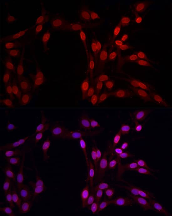 Immunocytochemistry/ Immunofluorescence: Lamin B1 Antibody - Azide and BSA Free [Lamin B1] - Immunofluorescence analysis of PC-12 cells using Lamin B1 Rabbit pAb  at dilution of 1:100 (40x lens). Secondary antibody: Cy3-conjugated Goat anti-Rabbit IgG (H+L)  at 1:500 dilution. Blue: DAPI for nuclear staining.