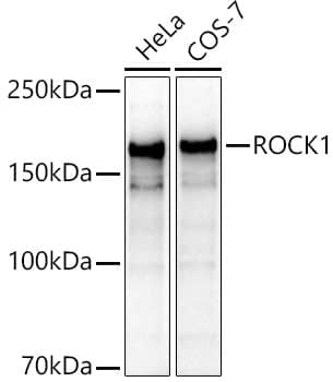 Western Blot: ROCK1 Antibody - BSA Free [ROCK1] - Western blot analysis of various lysates, using [KO Validated] ROCK1 Rabbit pAb  at  1:1000 dilution.Secondary antibody: HRP Goat Anti-Rabbit IgG (H+L)  at 1:10000 dilution.Lysates/proteins: 25ug per lane.Blocking buffer: 3% nonfat dry milk in TBST.Detection: ECL Basic Kit .Exposure time: 10s.