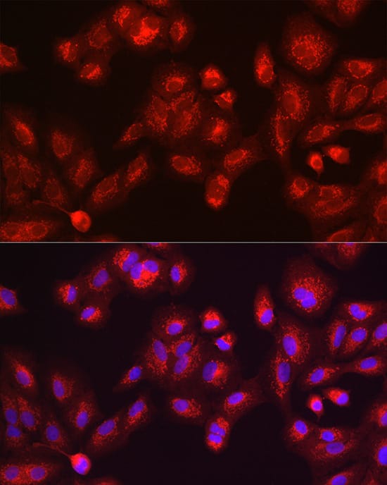 Immunocytochemistry/ Immunofluorescence: Galactosylceramidase/GALC Antibody - BSA Free [Galactosylceramidase/GALC] - Immunofluorescence analysis of A-549 cells using Galactosylceramidase/GALC Rabbit pAb  at dilution of 1:200 (40x lens). Secondary antibody: Cy3-conjugated Goat anti-Rabbit IgG (H+L)  at 1:500 dilution. Blue: DAPI for nuclear staining.