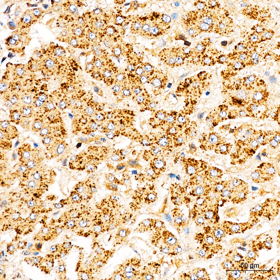 Immunohistochemistry: Frataxin Antibody - Azide and BSA Free [Frataxin] - Immunohistochemistry analysis of paraffin-embedded Human liver tissue using Frataxin Rabbit pAb  at a dilution of 1:200 (40x lens). High pressure antigen retrieval performed with 0.01M Citrate Bufferr (pH 6.0) prior to IHC staining.