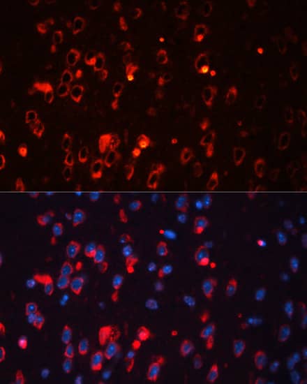 Immunocytochemistry/ Immunofluorescence Kv1.1 Antibody - Azide and BSA Free