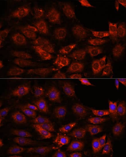 Immunocytochemistry/ Immunofluorescence: GIT1 Antibody - Azide and BSA Free [NBP3-03734] - Immunofluorescence analysis of C6 cells using [KO Validated] GIT1 Rabbit pAb (A15437) at dilution of 1:100. Secondary antibody: Cy3 Goat Anti-Rabbit IgG (H+L) (AS007) at 1:500 dilution. Blue: DAPI for nuclear staining.