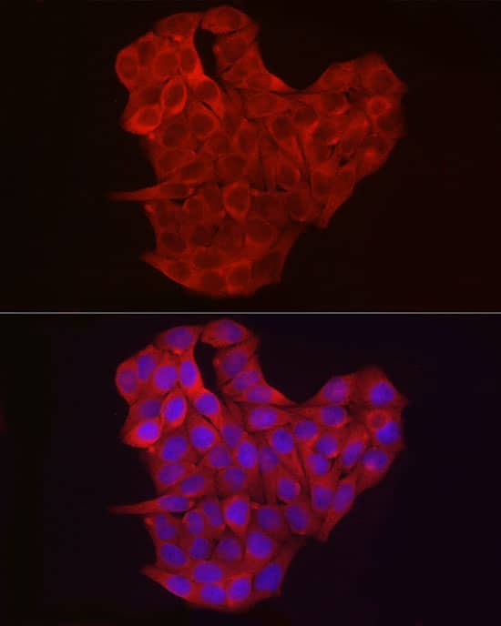 Immunocytochemistry/ Immunofluorescence: Exostosin 1 Antibody - Azide and BSA Free [NBP3-03736] - Immunofluorescence analysis of HeLa cells using Exostosin 1 Rabbit pAb (A2030) at dilution of 1:100 (40x lens). Blue: DAPI for nuclear staining.