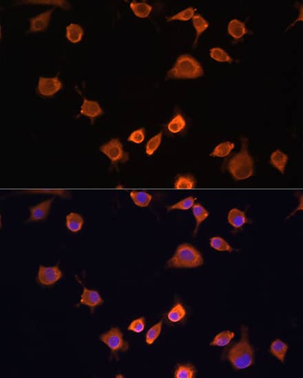 Immunocytochemistry/ Immunofluorescence: NF2/Merlin Antibody - BSA Free [NF2/Merlin] - Immunofluorescence analysis of L929 cells using [KD Validated] NF2/Merlin Rabbit pAb  at dilution of 1:100. Blue: DAPI for nuclear staining.