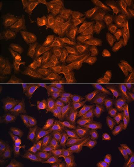 Immunocytochemistry/ Immunofluorescence: NF2/Merlin Antibody - BSA Free [NF2/Merlin] - Immunofluorescence analysis of U2OS cells using [KD Validated] NF2/Merlin Rabbit pAb  at dilution of 1:100. Blue: DAPI for nuclear staining.